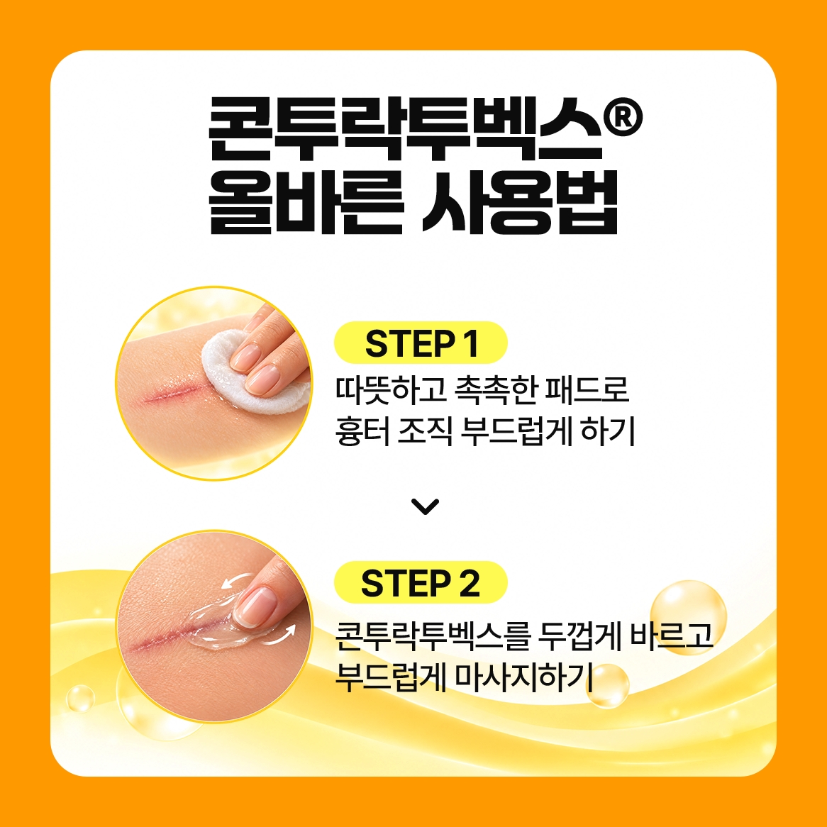 흉터치료연고 패드로 준비하고 두껍게 발라 마사지 콘투락투벡스
