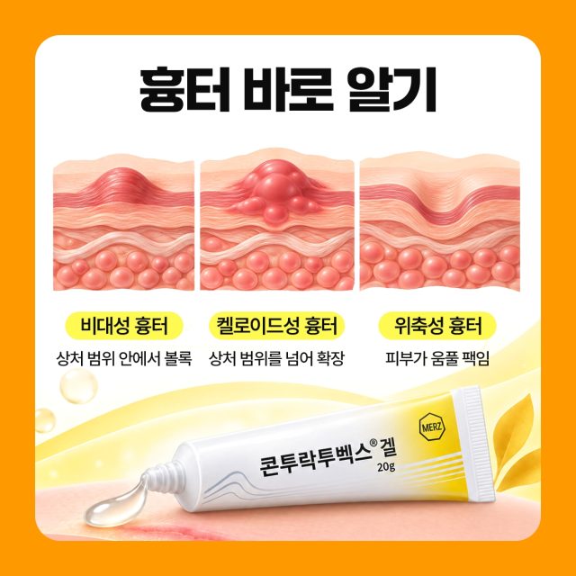 흉터 치료 연고, 흉터 모양 구분과 특징 안내 콘투락투벡스